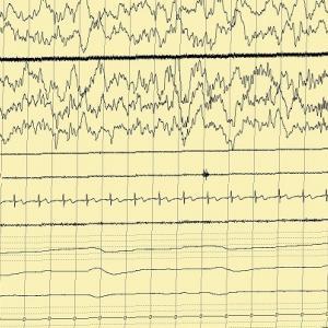 EEG graph measuring brain activity during deep sleep